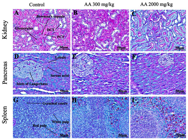 Photomicrographs of vital organs demonstrating Periodic acid Schiff staining of kidneys, pancreas and spleen.