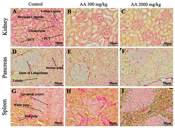 Photomicrographs of vital organs representing Oil O Red staining of kidneys, pancreas and spleen.