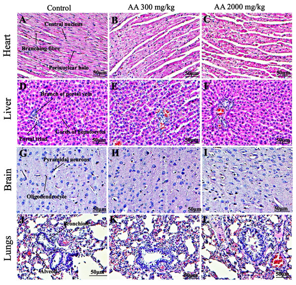 Photomicrographs of vital organs displaying H&E staining of heart, liver, brain and lungs.