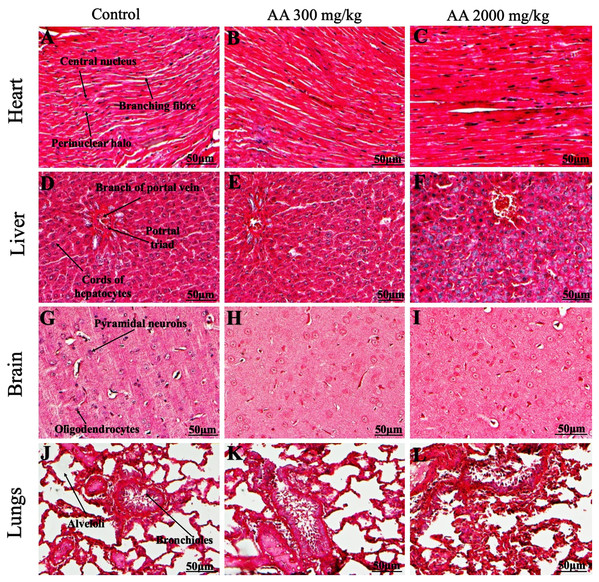 Photomicrographs of vital organs presenting Masson trichrome staining of heart, liver, brain and lungs.