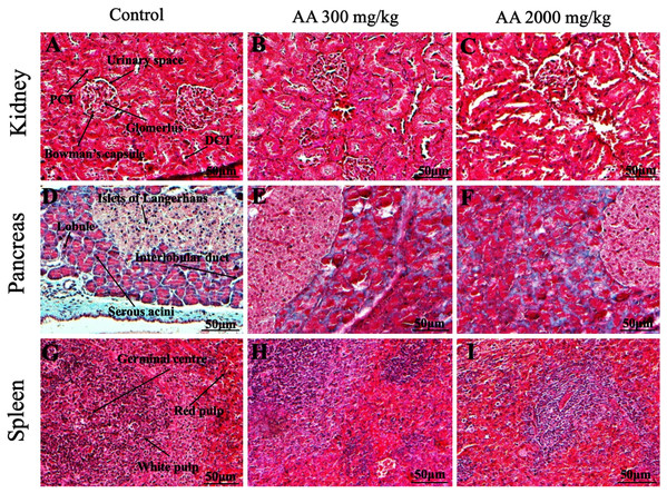 Photomicrographs of vital organs presenting Masson trichrome staining of kidneys, pancreas and spleen.