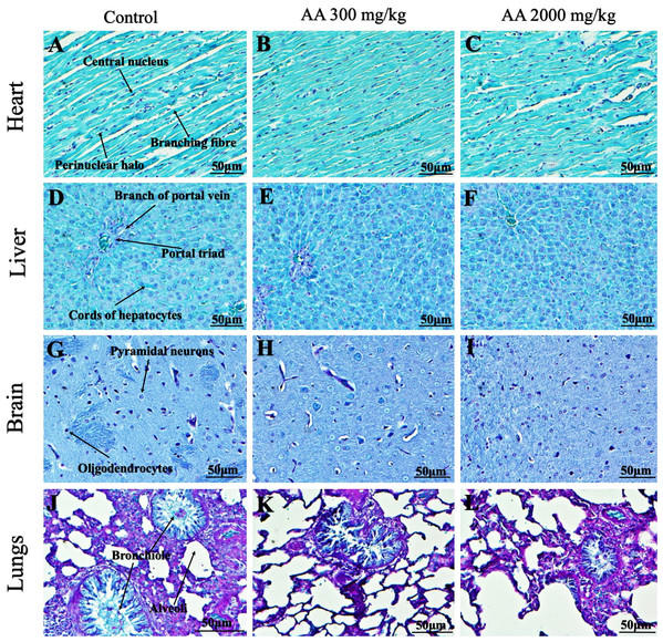 Photomicrographs of vital organs demonstrating Periodic acid Schiff staining of heart, liver, brain and lungs.