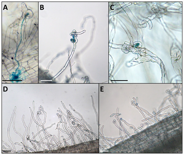 Phenotype of the infection threads in plants with different LykX alleles in the presence of nodX– strain RCAM1026 gusA.