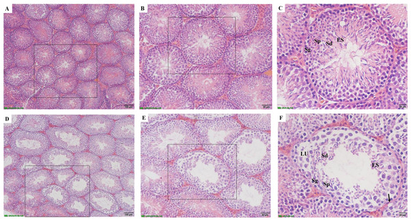 The effects of CAP exposure on seminiferous tubule morphology in testis.