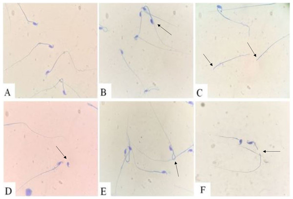 Sperm morphology.