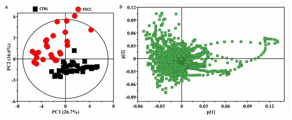 The 2D PCA scores plots (A) and loading plots (B) based on 1H CPMG NMR spectra of serum obtained from healthy controls (CTRL) and ESCC group (R2X(PC1 + PC2) = 43.3%).