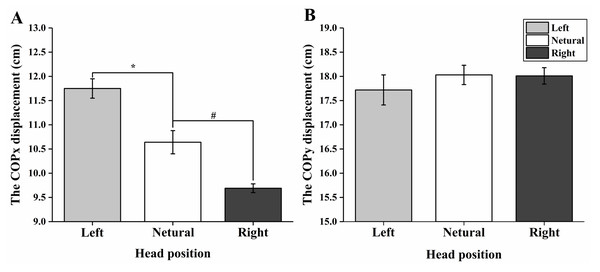 Comparison of COP displacements between the left, right, and neutral positions during voluntary head movements.