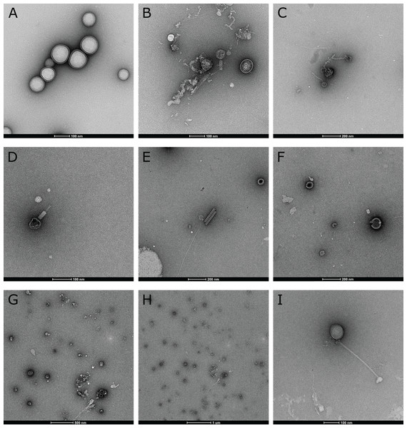Electron microscopic evidence of virus-like particles in stream biofilm samples.