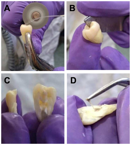 Cutting technique of vertical dental organ to obtain pulp.