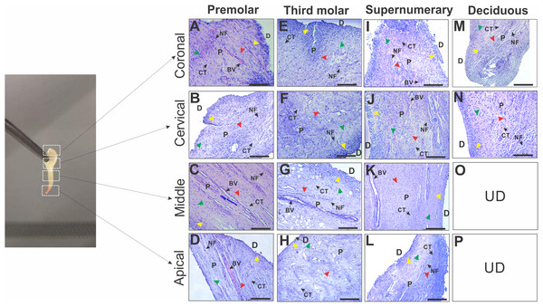 Photomicrographs of histologic sections of different regions in dental pulp from premolars, third molar, supernumerary and deciduous teeth.