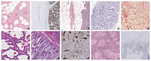 Examples of all 10 tissue—staining categories in the development dataset.
