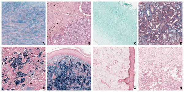 Examples of all eight tissue-staining categories in the dissimilar dataset.