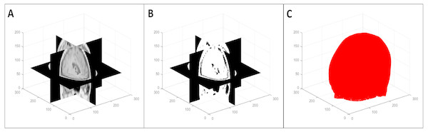 Multi-level volume thresholding: (A) resampled volume from the previous step, (B) segmented volume, and (C) resulting point cloud.