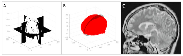 Representative 2D image extraction: (A) segmented volume, (B) segmented point cloud with the plane of best symmetry shown as a circular plane, and (C) 2D image extracted from the symmetry plane.