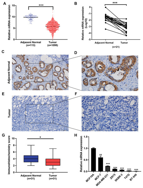 Expression of IGSF10 in breast cancer.