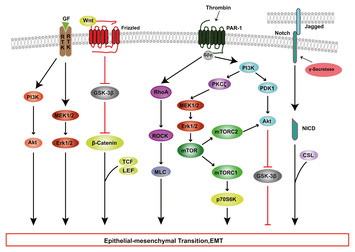 Polarity and epithelial-mesenchymal transition of retinal pigment ...