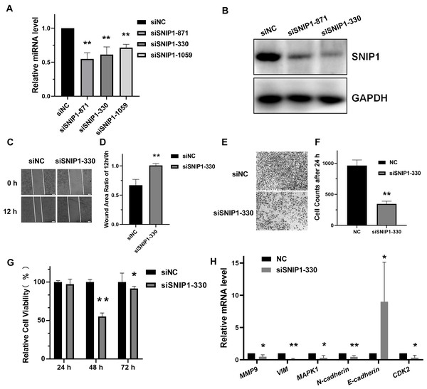 Knockdown of SNIP1 inhibited HeLa cells migration and proliferation.