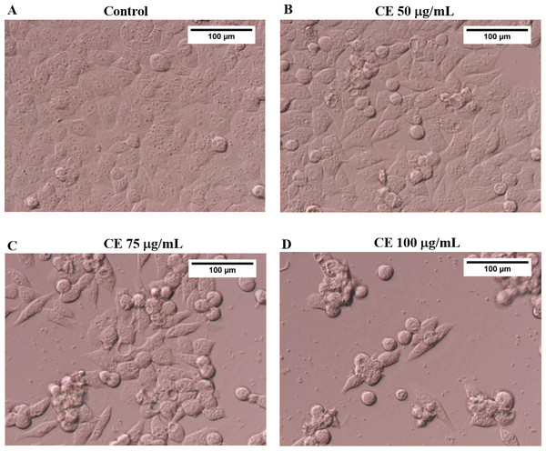 Morphological change of HepG2 cells after treatment with CE for 24 h (200X magnification).