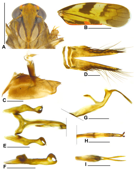 Metacephalus mamaquilla sp. nov., male holotype.