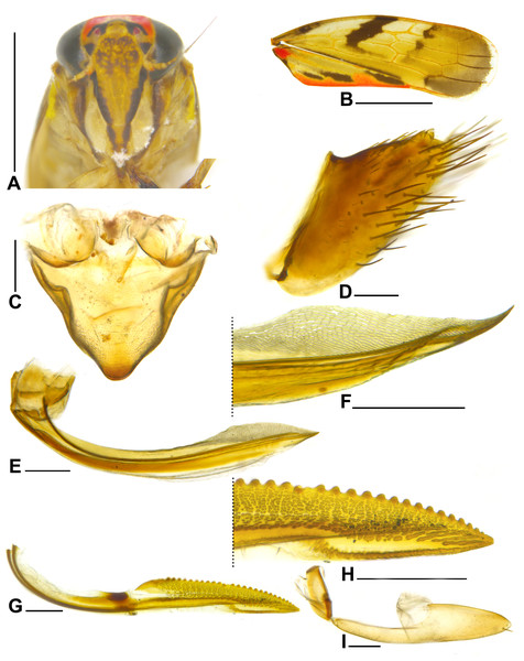 Metacephalus mamaquilla sp. nov., female paratype.