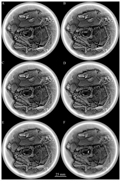 Micro-computed scanning slices of cranial bones.