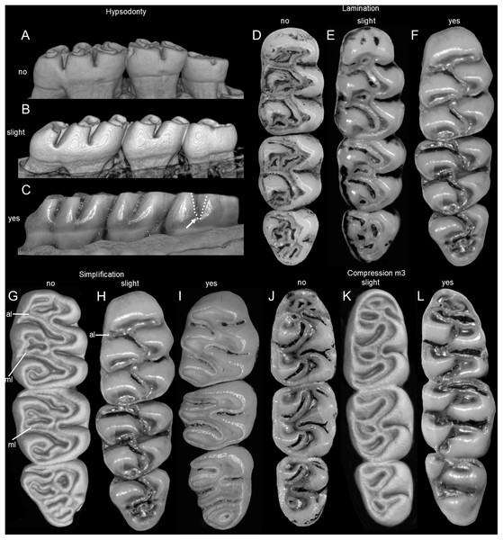 Four selected traits discussed in the main text illustrating molar variability in extinct (†) and extant oryzomyines.