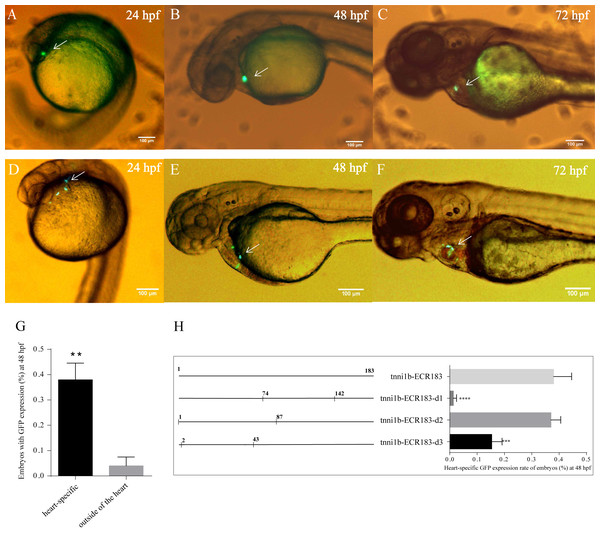 GFP expression after the injection of zebrafish enhancers.