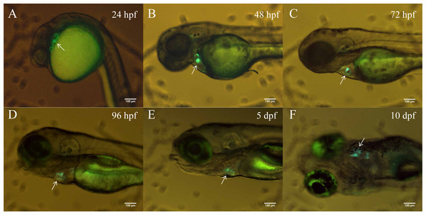 The heart-specific GFP expression in the stable transgenic zebrafish line Tg (tnni1b-ECR183-d2: GFP).