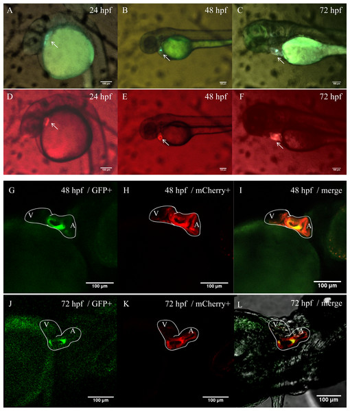 Heart-specific GFP expression in zebrafish embryos of Tg (tnni1b-ECR183-d2: GFP; myl7: mCherry).