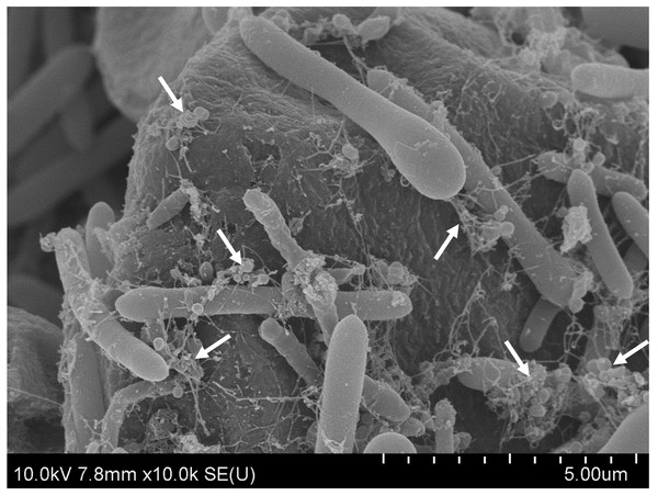 The SEM of C. manihotivorum CT4T grown on basal medium with cassava pulp as the sole carbon source.