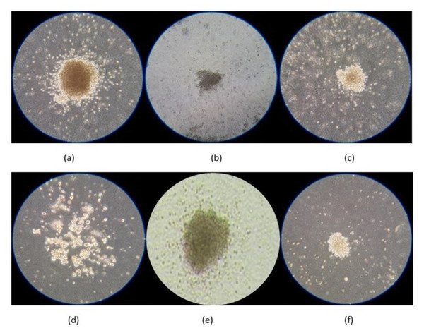 Microscopic images of lineage-committed hematopoietic progenitors using Colony Forming Unit assay as taken using a smartphone (Samsung Galaxy J6).