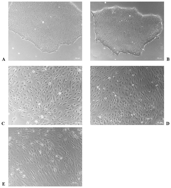 The morphological characteristics of the undifferentiated and the differentiated H1 cells.