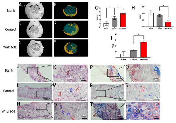 Wnt16 enhanced mineralized tissue formation in vivo by PDCs/ β-TCP implantation.