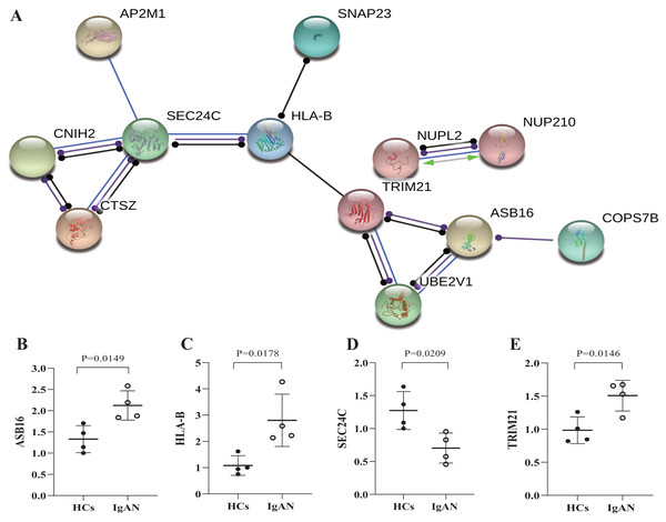 PPI network analysis of ceRNA-associated genes and qRT-PCR validation of the potentially hub genes.