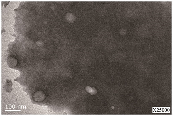 Image of the LSPMbs obtained by transmission electron microscope.