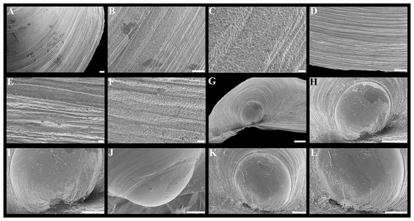 Scanning electron micrographs of Parathyasira fragilis sp. nov.