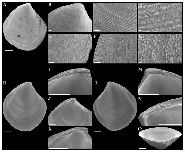 Scanning electron micrographs of “Axinulus” roseus sp. nov.