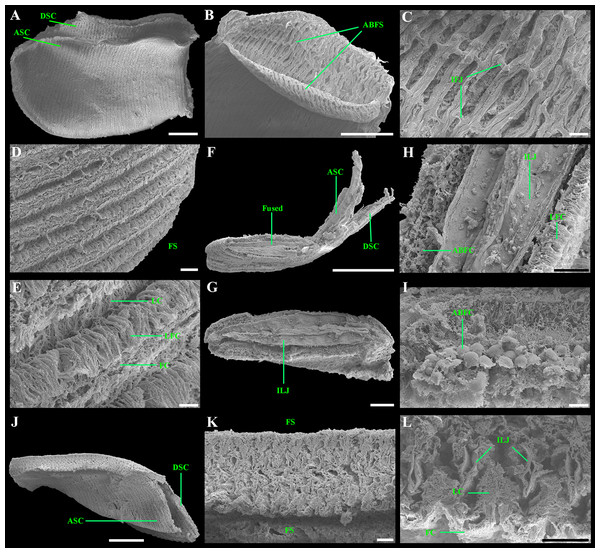 Scanning electron micrographs of the ctenidium and filaments of “Axinulus” roseus sp. nov.