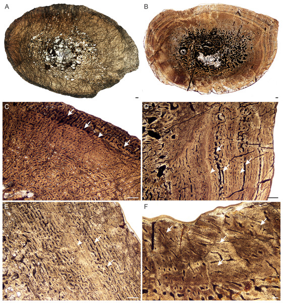 Transverse sections of the bone histology of Lystrosaurus maccaigi, Age Class II.