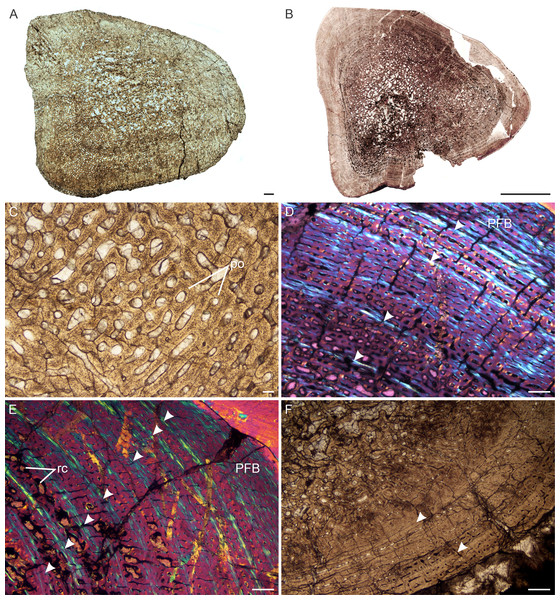 Transverse sections of the bone histology of Lystrosaurus maccaigi, Age Class III.