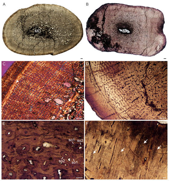 Transverse sections of the bone histology of Lystrosaurus maccaigi, Age Class IV.