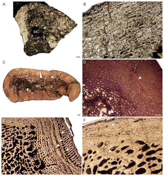 Transverse sections of the bone histology of Lystrosaurus curvatus, Age Class I, III.