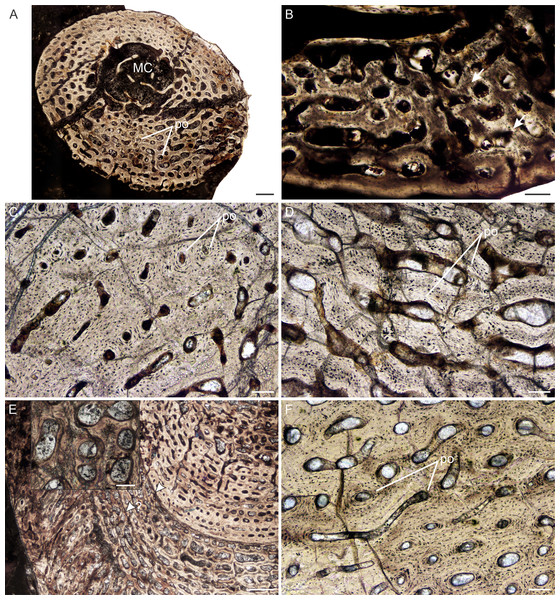 Transverse sections of the bone histology of Lystrosaurus murrayi, Age Class I–IV.