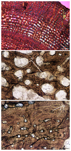 Transverse sections of the bone histology of Lystrosaurus murrayi, Age Class IV.
