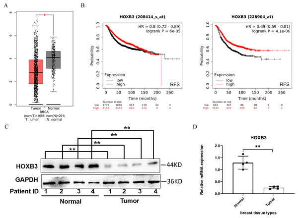HOXB3 expression in breast cancer patients compared with healthy controls.