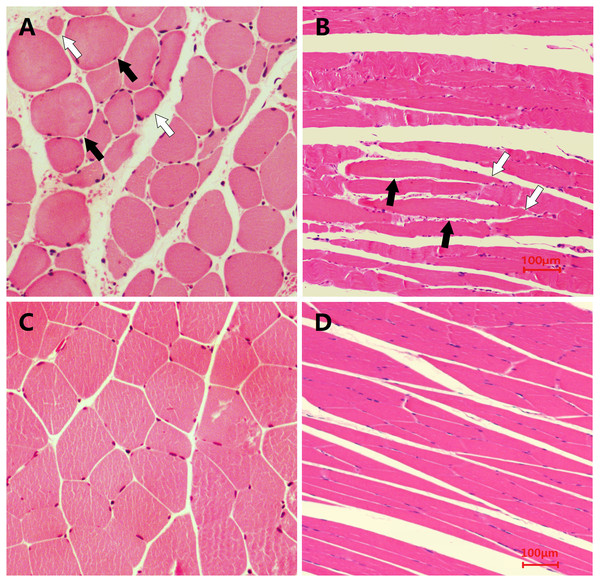 Microscopic views of HE staining of muscle fibres from the two groups of rats (400×).