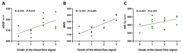 Linear correlation plots between blood flow signals and HIF-1α levels, VEGF levels and MVD performed in the active MTrP group.