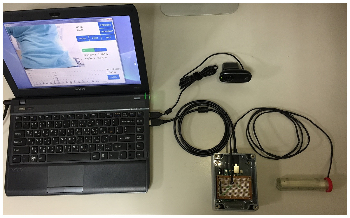 Digitizing Abdominal Palpation With A Pressure Measurement And ...