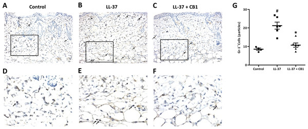 CB1 reduced neutrophils recruitment to the rosacea-like skin lesions.