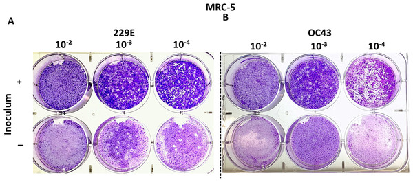 Plaque assays with MRC-5 cells.
